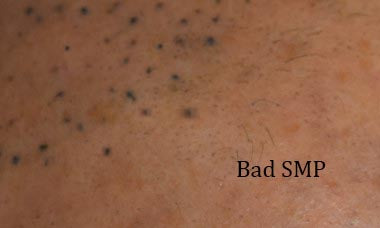 Remove small tattooing/SMP/PMU – Complexion Correction